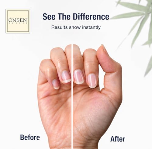 Onsen Secret Cuticle Cream, Cuticle Oil in Deep Action - Japanese Natural Healing Minerals Nail Care Serum and Butter, Sooth, Repair, and Strengthen Cuticles and Nails, Visible Results, 30 ml - Image 2