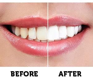 Active Wow Activated Charcoal Toothpaste - Charcoal Toothpaste for Whitening, Charcoal Teeth Whitening, Made with Organic Coconut Oil & Xylitol, Charcoal Activated Toothpaste (4 Ounce (Pack of 1)) - Image 7