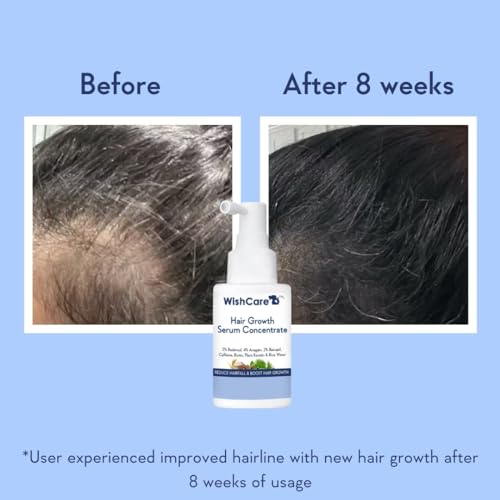 Hair Growth Serum Concentrate - Rosemary, 3% Redensyl, 4% Anagain, 2% Baicapil, Caffeine, Biotin, Plant Keratin & Rice Water - Image 4