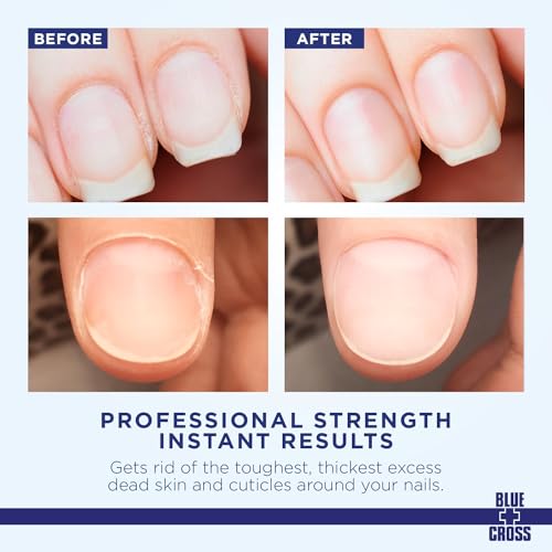 Blue Cross Cuticle Remover Liquid, Cuticle Softener for Nails, Professional Nail + Cuticle Care with Lanolin for Brittle Nails, Hang Nails, Hydrating, Moisturizing, Dry Cuticles, Made in USA, 6oz - Image 2
