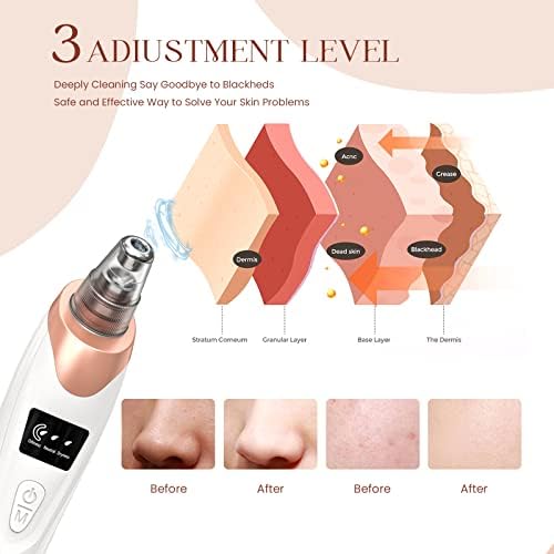 2024 Newest Blackhead Remover Pore Vacuum,Facial Pore Cleaner-5 Suction Power,5 Probes,USB Rechargeable Blackhead Vacuum Kit Electric Acne Extractor Tool for Women - Image 3