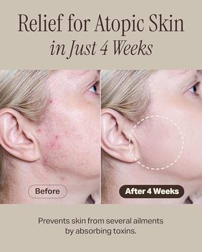 Recovery Mud Clay Face Mask | Hydrating & Moisturizing Deep Pore Cleanser Korean Face Mask w/ 91.8% Nature-Derived Ingredients | Gentle K Beauty Oil Control Wash Off Mud Face Mask (3.72 fl oz) - Image 7