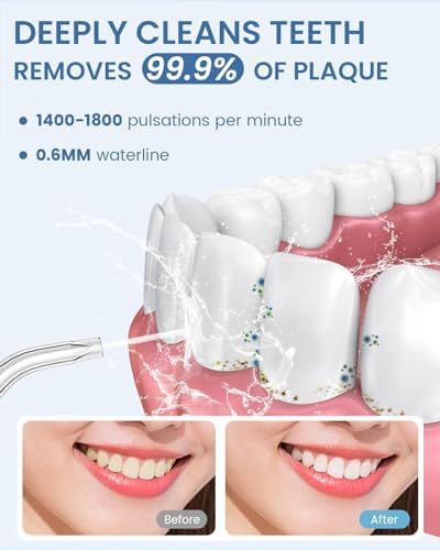 Water Flosser Teeth Pick: 9 Jet Tips Cordless Oral Irrigator with 300ML, 5 Modes Portable Power Dental Flossers, IPX7 Waterproof Rechargeable Electric Waterflosser Machine for Home Travel, Black - Image 2