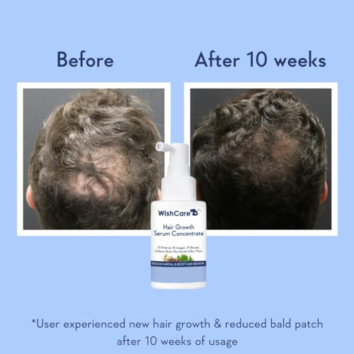 Hair Growth Serum Concentrate - Rosemary, 3% Redensyl, 4% Anagain, 2% Baicapil, Caffeine, Biotin, Plant Keratin & Rice Water - Image 3