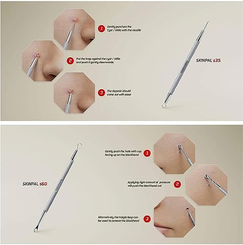 Skinpal Pimple Popper Tool Kit | Milia Remover | Lancets for Facial Extraction | Whitehead Extractor Tool | Comedone Extractor | Blackhead Remover Tool | Acne Needle Tool & Cyst Removal Tool. - Image 2