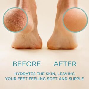 Lee Beauty Professional Callus Remover for Feet – Original, Powerful Formulation – Extra Strength Gel, Home Pedicure Foot Spa Results – Cracked & Dead Dry Skin Supplies – 8 Oz