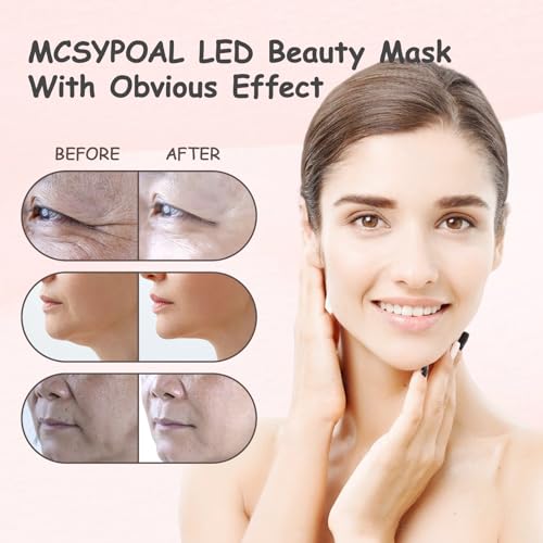 Red Light Therapy for Face, Led Face Mask Light Therapy, 7 Colors LED Facial Skin Care Mask - Image 6
