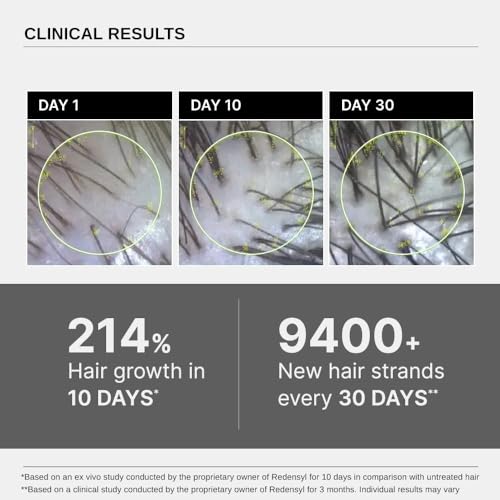 Bare Anatomy Advanced Hair Growth Serum | 3% Redensyl + 4% Anagain + 3% Baicapil + 1% Capilia Longa, Rosemary, Biotin & Rice Extract | Hair growth & Hair fall control serum for Women & Men | 30mL - Image 4