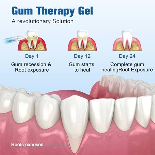 Taileden Gum Repair Therapy Gel, Taileden Gum Care Gel,Taileden™ Gum Therapy Gel,Gum Shield Therapy Gel Gum Therapy Gel for Recessed Gums,Teeth Whitening Essence Pen Reduce Yellowing Oral Care - Image 3