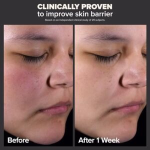 Paula’s Choice SKIN PERFECTING 2% BHA Liquid Salicylic Acid Exfoliant-Facial Exfoliant for Blackheads, Enlarged Pores, Wrinkles & Fine Lines
