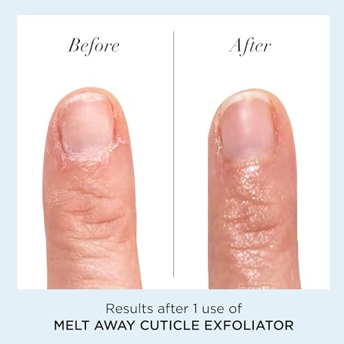 butter LONDON Cuticle Remover Liquid, Melt Away - Cuticle Oil Exfoliator & Softener Gently Removes Dry, Overgrown Cuticles for Healthy Looking Nails - Fast-Acting & Pain-Free Formula - 0.4 Fl Oz - Image 4