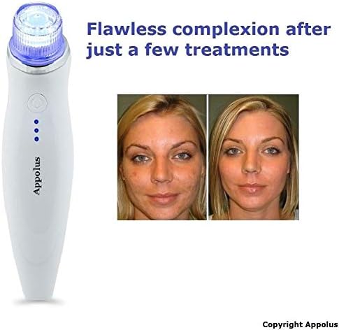 Microdermabrasion Machine - Appolus Premium Diamond Microdermabrasion Anti-Aging SkinTightening Device - 2 Diamond Tips - 5 Heads - Blackhead Blemishes Remover - Pore Line Wrinkle Sagging Minimizer - Image 4