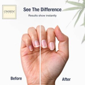 Onsen Cuticle Cream w/Nail Cuticle Oil | Cuticle Softener with Japanese Natural Healing Minerals | Nail Care Serum to Soothe, Repair & Strengthen Cuticles and Nails | Visible Results (1 Count/15 ml)