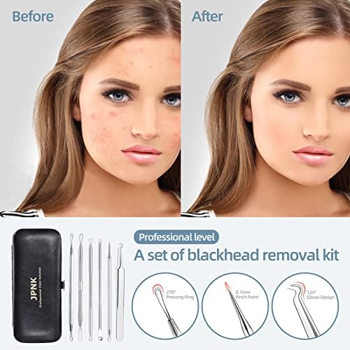 JPNK Blackhead Remover Tool Comedones Extractor Acne Removal Kit for Blemish, Whitehead Popping, 6 Pcs Zit Removing for Nose Face Tools with a Leather Bag - Image 3