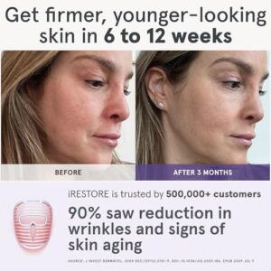 iRestore LED Face Mask Light Therapy | Blue, Infrared & Red Light Therapy for Face | Illumina Skincare Device Facemask – Youthful Radiant Skin with Reduced Wrinkles, Fine Lines | Contour | 360 LEDs