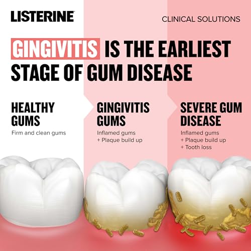 Listerine Clinical Solutions Gum Health Antiseptic Mouthwash, Antigingivitis & Antiplaque Oral Rinse Helps Prevent Buildup & Kills Germs for Healthier Gums, ICY Mint, Twin Pack, 2 x 1 L - Image 4