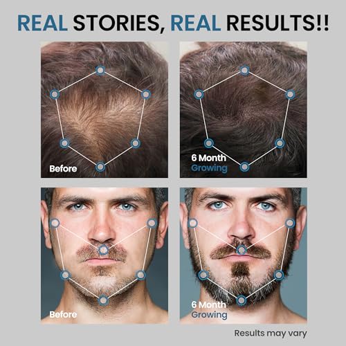 5% Minoxidil Hair Growth Serum for Men - Extra Strength Treatment to Combat Hair Loss and Thinning (2 Pack) - Image 3