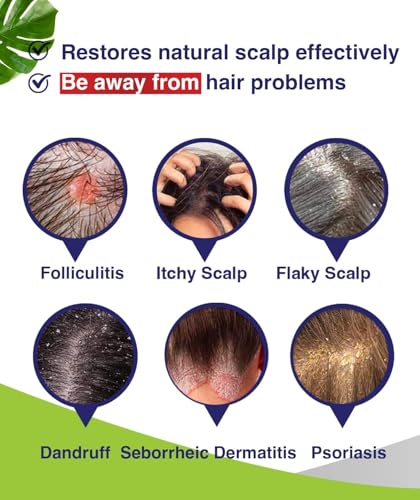 Anti-Fungal Shampoo for Folliculitis, Seborrheic Dermatitis, Scalp Psoriasis - Relieves Itchy & Dry Scalp - Image 2