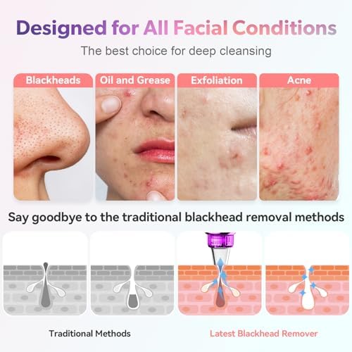 Newest Blackhead Remover Pore Vacuum Upgraded Facial Pore Cleaner Electric Comedone Whitehead Extractor Tool-5 Suction Power,5 Probes,USB Rechargeable Blackhead Vacuum Kit for Women & Men - Image 3