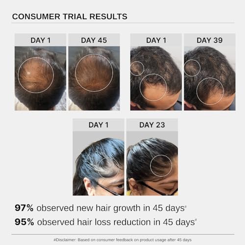 Bare Anatomy Advanced Hair Growth Serum | 3% Redensyl + 4% Anagain + 3% Baicapil + 1% Capilia Longa, Rosemary, Biotin & Rice Extract | Hair growth & Hair fall control serum for Women & Men | 30mL - Image 5