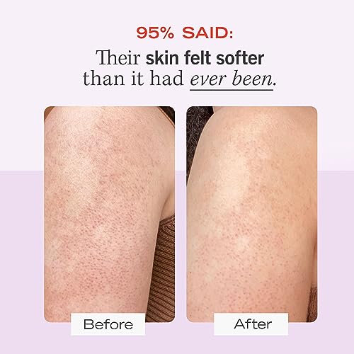 First Aid Beauty - KP Bump Eraser Body Scrub with 10% AHA, Keratosis Pilaris Skin Exfoliater with Glycolic and Lactic acids, Helps Reduce Chicken Skin Bumps, Safe for Sensitive Skin, 4 oz - Image 3