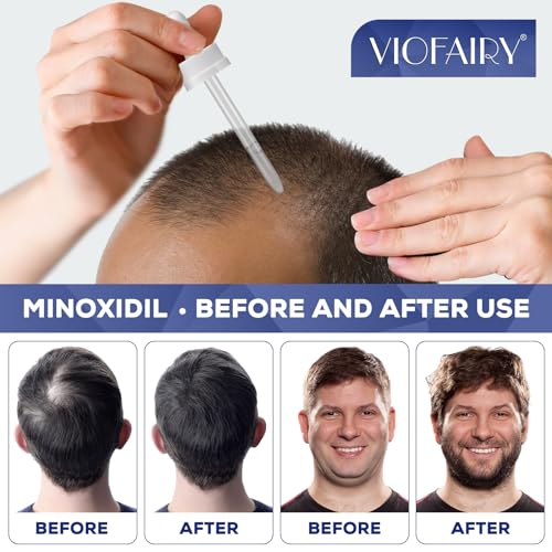 5% Minoxidil for Men's & Women's Hair Growth, Beard Growth, Regrowth Treatment, Combats Thinning Hair & Hereditary Hair Loss - Image 3