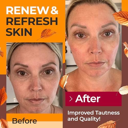 Collagen Peptides Powder for Women Hydrolyzed Collagen Supplements Types I - III Non-GMO Grass-Fed Gluten-Free Kosher Pareve Unflavored Easy to Mix Drink Healthy Hair Skin Joints Nails 10 Oz - Image 5