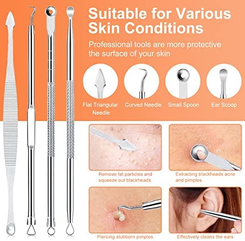 Pimple Popper Tool Kit, IUMAKEVP 15 PCS Professional Stainless Steel Blackhead Remover Comedone Extractor Tools for Removing Zit on Face - Acne Removal Kit with Metal Case (Silver) - Image 3