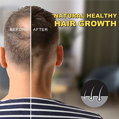 5% Minoxidil for Men and Women Hair Growth Oil, Biotin Serum, Hair Regrowth Treatment for Scalp Hair Loss, Natural, for Thicker Longer Fuller Healthier Hair 2.02 oz - Image 5
