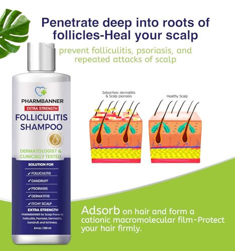 Anti-Fungal Shampoo for Folliculitis, Seborrheic Dermatitis, Scalp Psoriasis - Relieves Itchy & Dry Scalp - Image 4