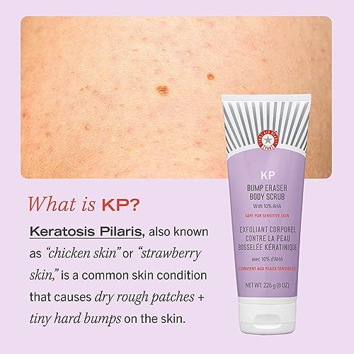 First Aid Beauty - KP Bump Eraser Body Scrub with 10% AHA, Keratosis Pilaris Skin Exfoliater with Glycolic and Lactic acids, Helps Reduce Chicken Skin Bumps, Safe for Sensitive Skin, 4 oz - Image 6