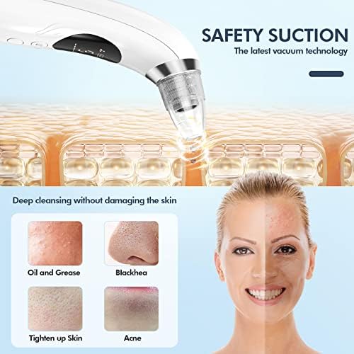 Blackhead Remover Pore Vacuum, Upgraded Black Head Remover for Face, Electric Acne Comedone Whitehead Extractor Tools-5 Suction Power, 5 Probes, USB Rechargeable Pimple Popper Tool Kit - Image 5