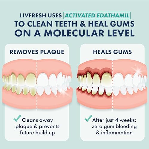 Toothpaste Gel, Clinically Proven to Remove Plaque 250% Better, Improves Gum Health 190% Better, Prevents & Reduces Tartar, Freshens Breath, SLS Free Dental Gel, Wintergreen - Image 2