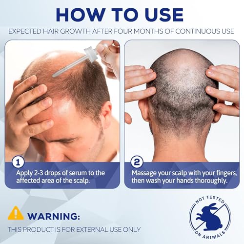 5% Minoxidil for Men's & Women's Hair Growth, Beard Growth, Regrowth Treatment, Combats Thinning Hair & Hereditary Hair Loss - Image 5